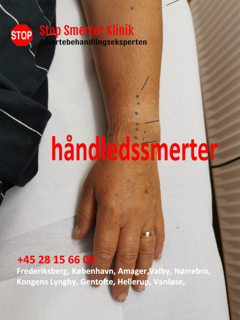 Håndledssmerter i Frederiksberg